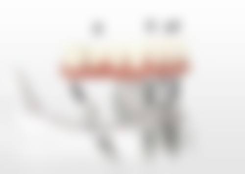 河南南阳方城万超口腔诊所价格表