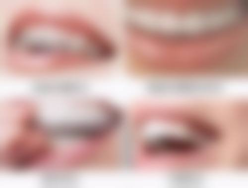 补牙后如何避免侧面补牙再次掉落？