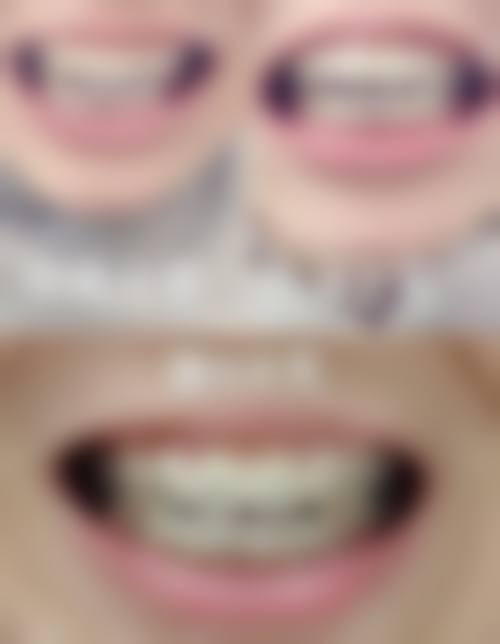 凯里市新贝尔口腔诊所擅长项目