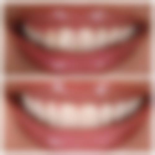 北京品格口腔医院口碑怎么样：患者好评如潮