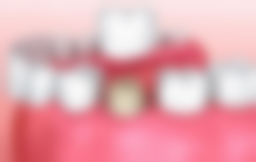 放疗化疗后拔牙选什么医院好？值不值？