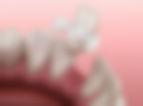 套了烤瓷牙5年后疼痛是材料老化吗，北京加减美医疗美容口腔科适合治疗吗