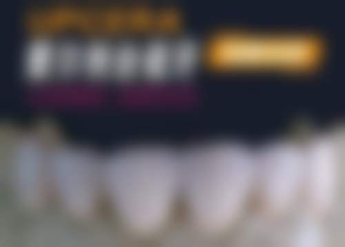 北京康铂口腔补牙洞一般多长时间？