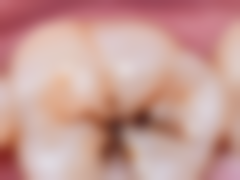 广州曙光医院口腔中 心治疗小宝宝牙齿地包天适合吗？