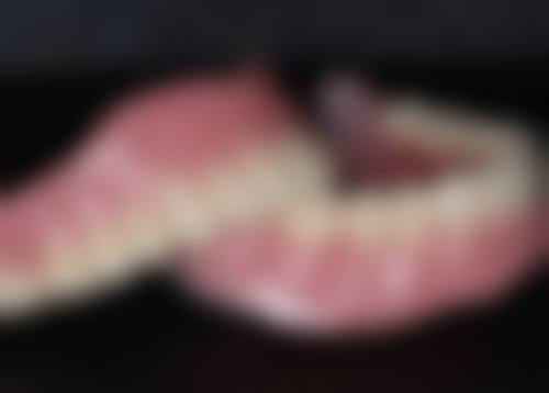 威兰德全瓷牙靠谱吗，值得选择吗？