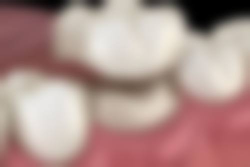 生理期做根管治疗在北京加减美医疗美容靠谱吗？