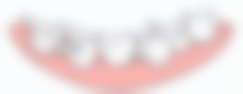 生理期做根管治疗在成都素美可靠吗？