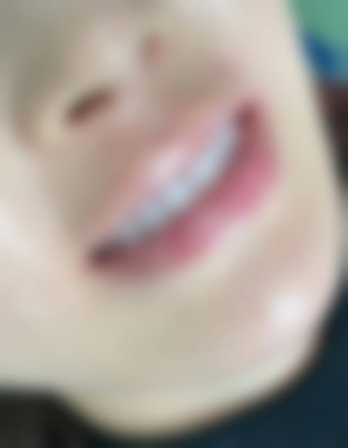 湖南益阳经典牙科诊所擅长项目