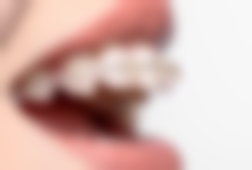 幼儿补牙杀神经后，恒牙形态异常能矫正吗？