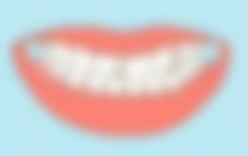 沈阳杏林整形外科医院箍牙拔4颗牙适合哪些人？