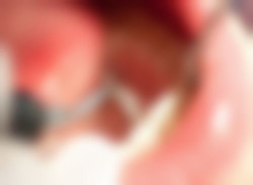 深圳华度口腔门诊部擅长项目