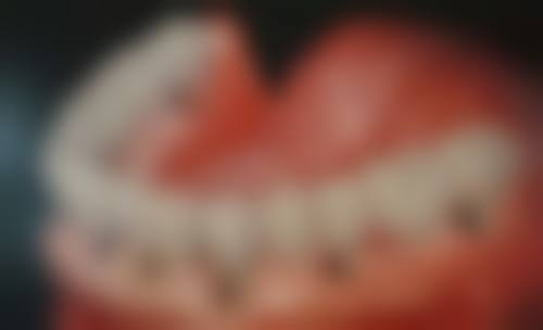 光明口腔门诊部仪器设备：精良科技助力口腔治疗