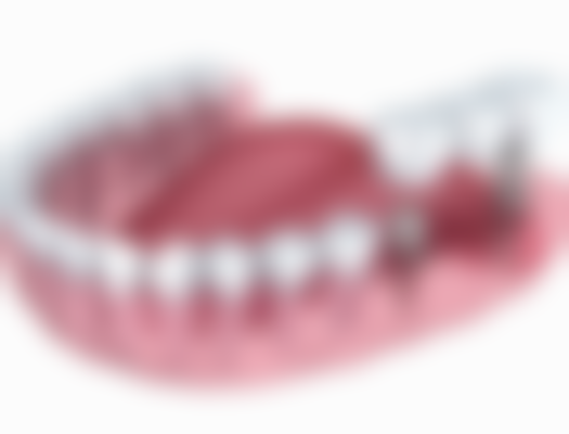 月经结束3 - 7天补牙在北京康铂口腔靠谱吗？