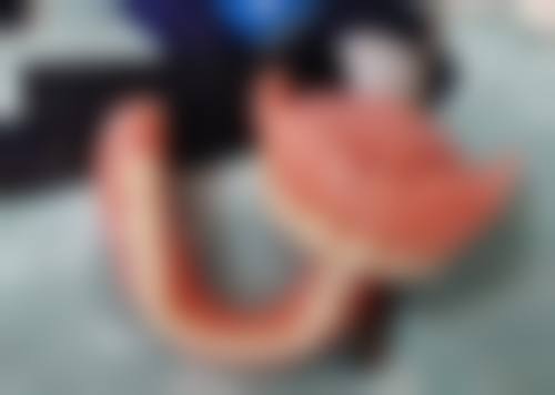 重庆韩佳牙博士口腔医院矫正三岁小孩地包天适合吗？