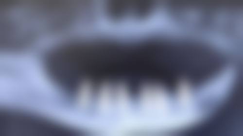 苏州牙博士口腔医院价格表：透明合理的收费