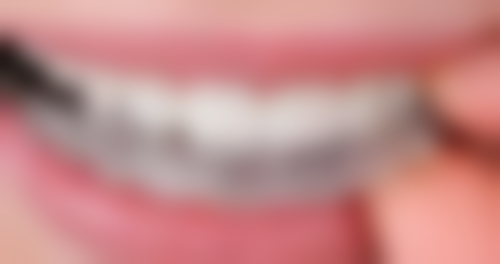 长时间间隔拔牙有什么好处？