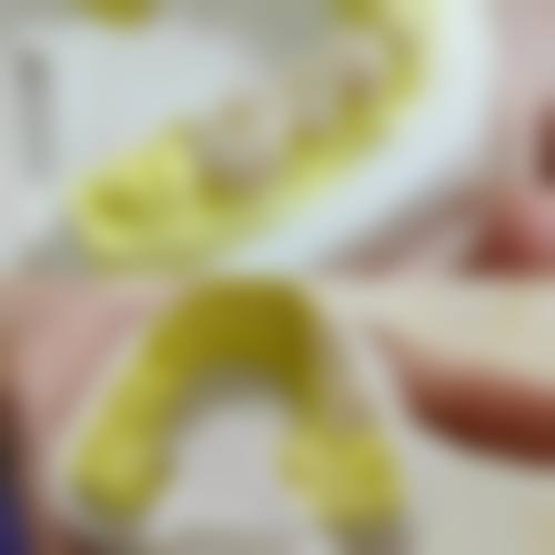 苏州牙博士口腔医院真实实例：见证神奇改变