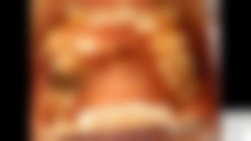 辽宁大连米嘉口腔口碑怎么样:患者好评满满