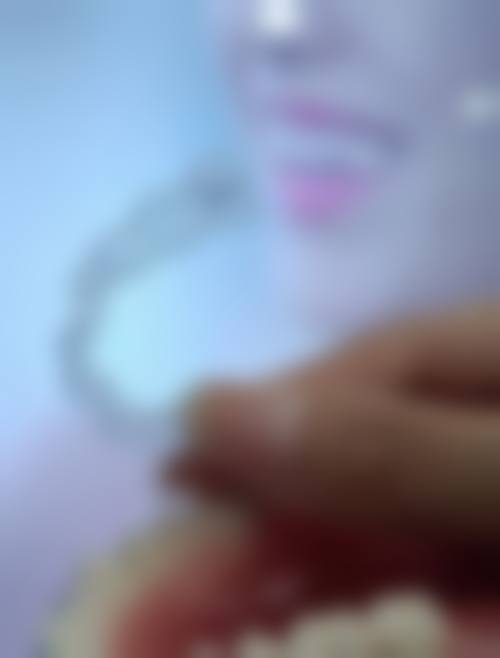 龙泉美伢口腔诊所真实实例:见证口腔蜕变奇迹