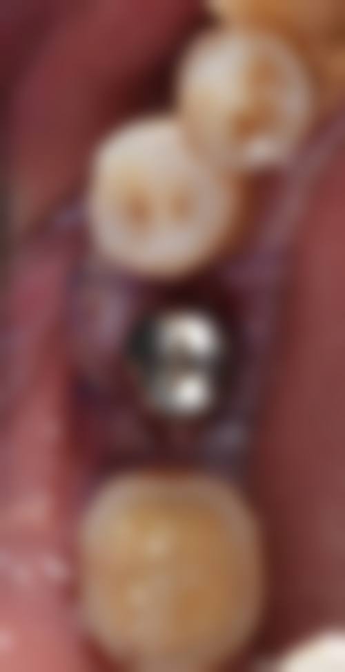 成都优品金典口腔门诊部真实实例