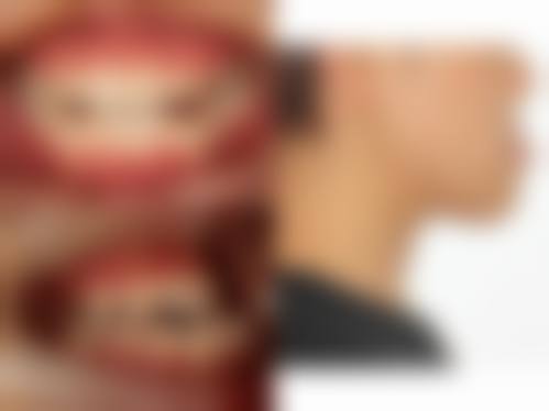 恒生口腔诊所口碑怎么样：患者真实评价