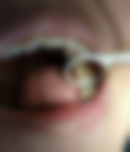 南宁奈尔思口腔门诊部价格表：合理透明，极高性价比