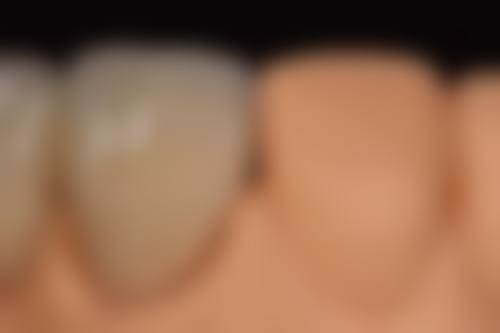 恒生口腔诊所真实实例：见证神奇改变