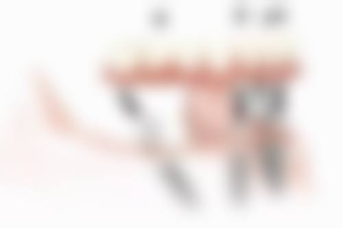 沈阳杏林整形外科医院做完根管多久补牙更合适