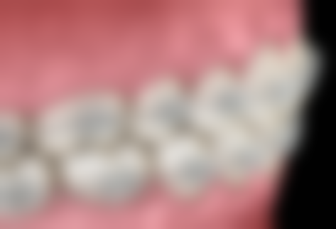 沈阳美莱医疗美容医院口腔科根管治疗的牙冠用医疗保险怎么样?