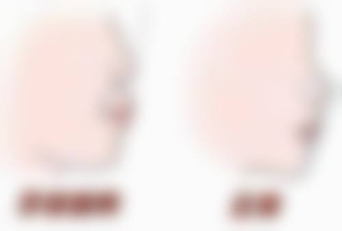 洗牙去除牙黄渍靠谱吗？