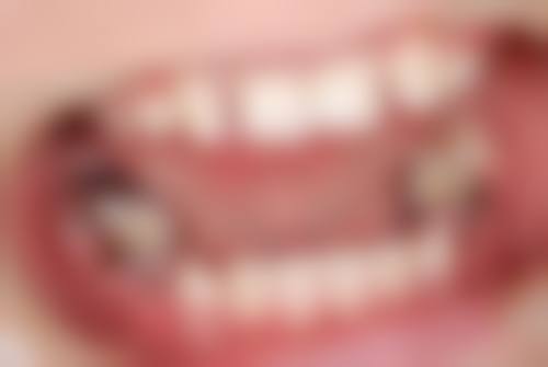 800元补牙在三等甲医院贵吗？