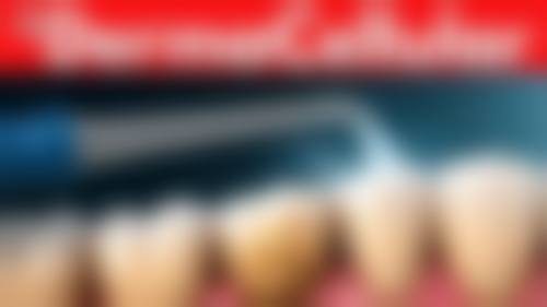 贵阳柏乐口腔医院真实实例:见证神奇蜕变