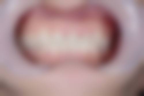 内蒙古呼伦贝尔瑞尔口腔门诊部真实实例