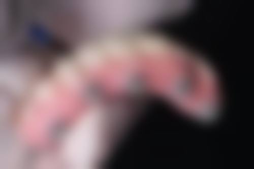 在什么情况下乳牙滞留必须去惠州精英惠口腔江北院区拔牙?