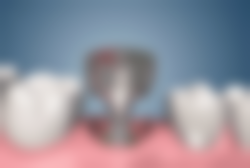 娄底贝康协合口腔医院口碑怎么样