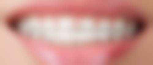 补牙用好的材料在AA医美医院怎么样