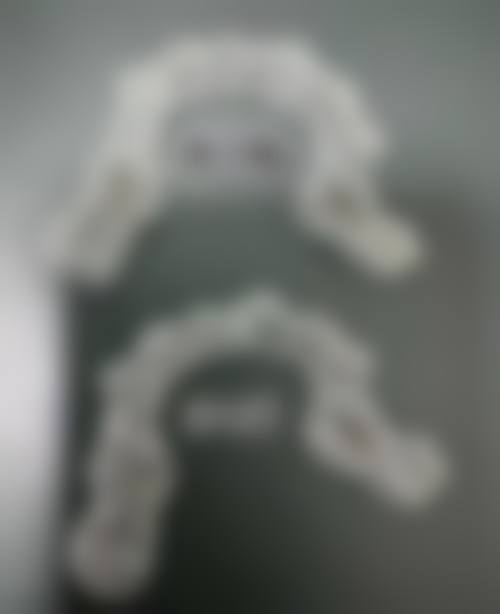 莆田荔城君正口腔门诊部真实实例