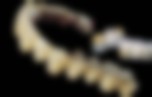 贵州遵义习水柯品牙管家口腔真实实例