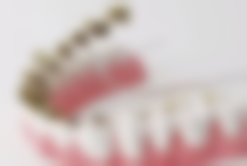 小朋友牙齿坏了做根管治疗的好处有哪些