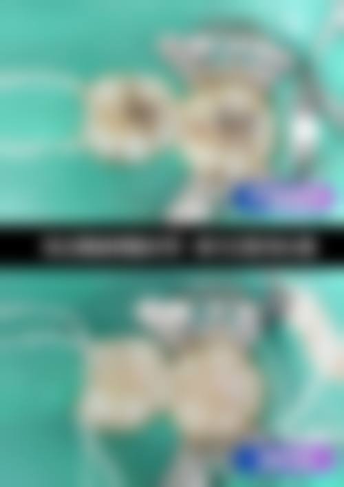 牙祖口腔门诊部(梅溪湖院)价格表