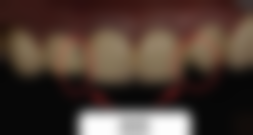 患者也可以通过改善口腔卫生习惯,提高自身的抵抗力。