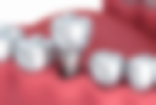 口腔疾病的治疗方案也特别重要。