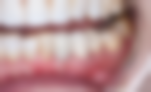 安徽合肥治仁口腔门诊部价格表