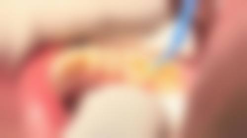 镇江丹阳王志东口腔诊所价格表：合理透明