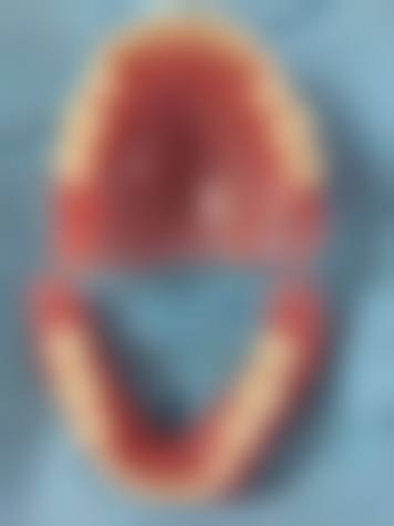 宁波鄞州牙管家口腔门诊部真实实例