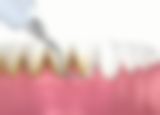 北京贝齿佳口腔门诊部牙根管治疗之后补牙靠谱吗