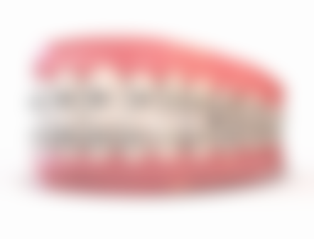 全瓷和烤瓷牙冠的区别是什么？从材质、价格、美观度等 5 大方面为你揭晓，看完不再纠结选哪个！ 