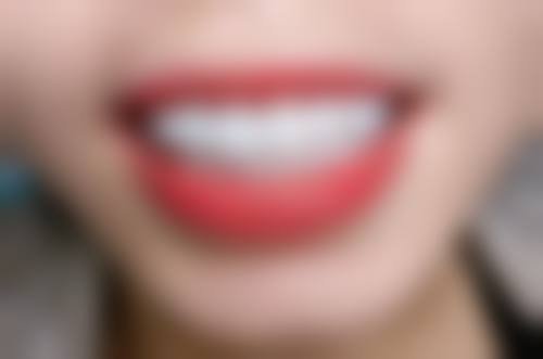 衢州柯城傅氏口腔诊所价格表