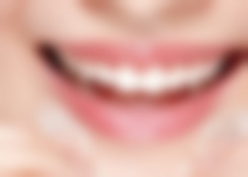 21岁去北京加减美医疗美容矫正地包天值不值?