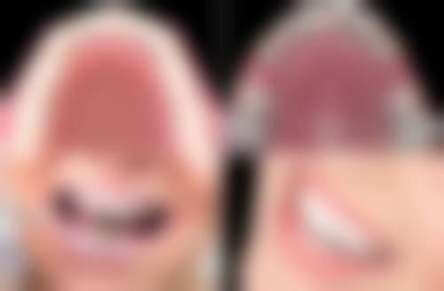 河南南阳方城万超口腔 3780 元矫正项目技术优势